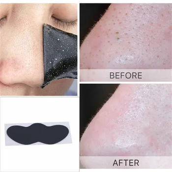 10Pcs/Pack inkštirų valiklio kaukė Nosies giluminio valymo juostelės porų taškai ance gydymas nosies pilingo kaukė odos priežiūrai